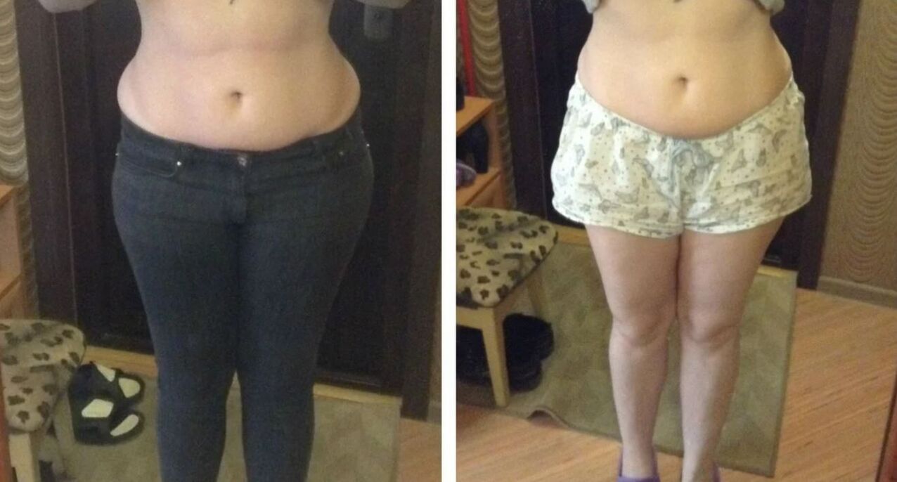Slopes for slimming diet